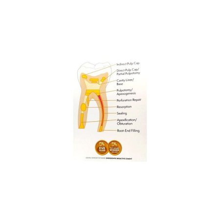 neomta-2-plus-bioceramiczny-bioaktywny-uszczelniacz-na-bazie-mta (3).jpg