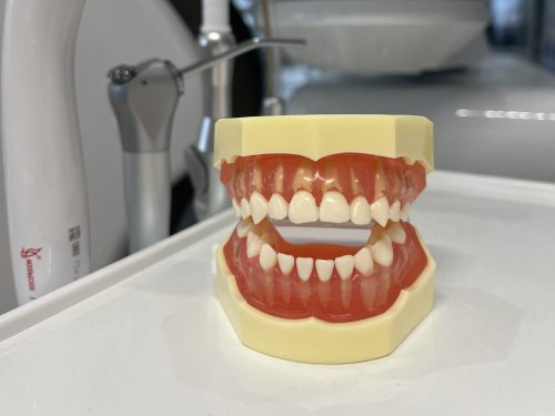 Przejdź do produktu Model szczęki dziecięcej zębów mlecznych,  ruchomych