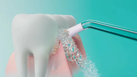 sonicare-philips-irygator-pow_17577.jpg